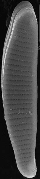 Eunotia Papilioforma Species Diatoms Of North America