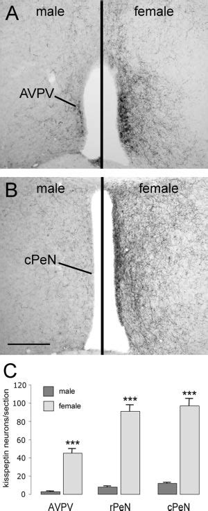 Sex Differences In Kisspeptin Immunoreactivity In The Rostral