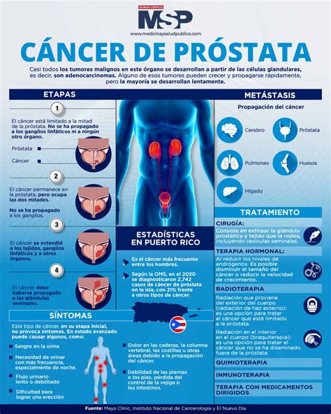 Cáncer de próstata