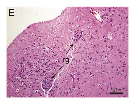 Histopathological Analysis Of Mice Brain And Cerebellum A Regular