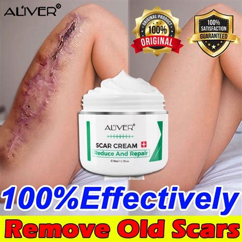 Scar Remover Peklat Scarminator Cream Strech Mark Remover Pimple For