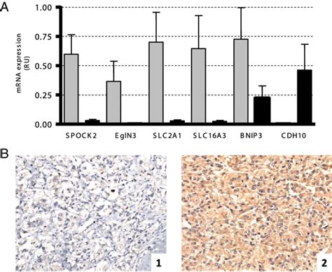 A Quantitative Real Time Rt Pcr Analysis Of Six Genes Significantly