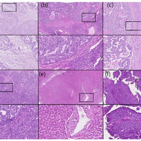 Representative Hematoxylin And Eosin Staining Of The Same Samples As