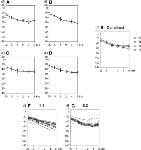 A Audiogram With The Average Air Conduction Thresholds Of All Affected Download Scientific