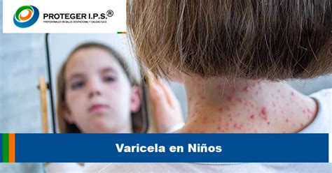 Descubre C Mo La Vacuna Contra La Varicela Te Protege Proteger Ips