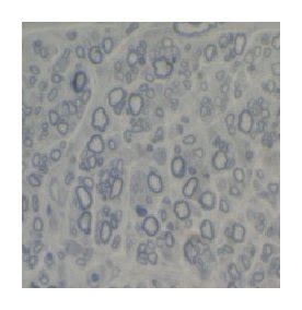 ((a), (b), and (c)) HE staining of transverse nerve slices from each ...