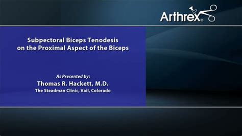 Arthrex Subpectoral Biceps Tenodesis On The Proximal Aspect Of The Biceps