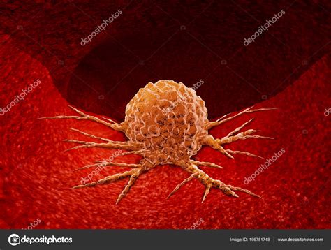 Cancer Anatomy Concept Stock Photo Lightsource