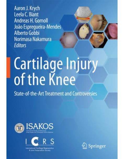 Cartilage Injury of the Knee - ebookshop.ro