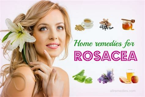 12 Home Remedies For Rosacea Causes Symptoms Prevention