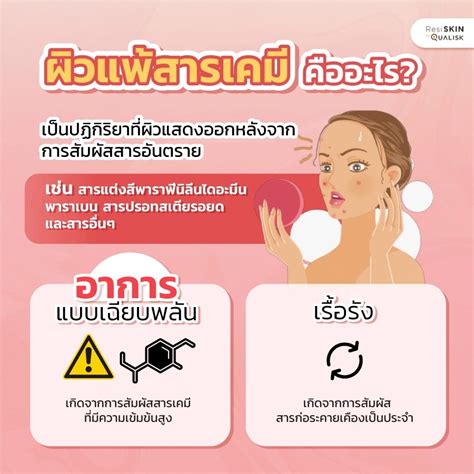 ผิวแพ้สารเคมี คืออะไร รีบรักษาก่อนที่จะสายเกินไป Qualisk