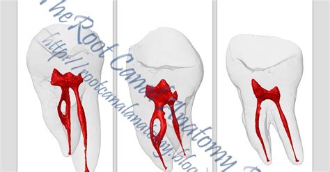 The Root Canal Anatomy Project Mandibular Second Molar