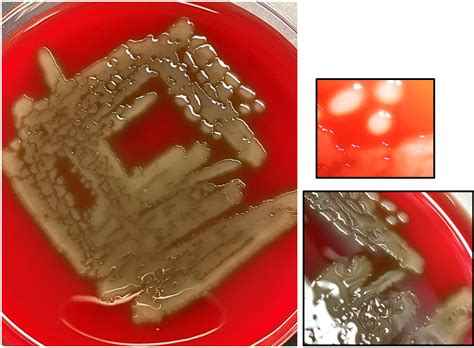 Streptococcus Pneumoniae Colony Morphology