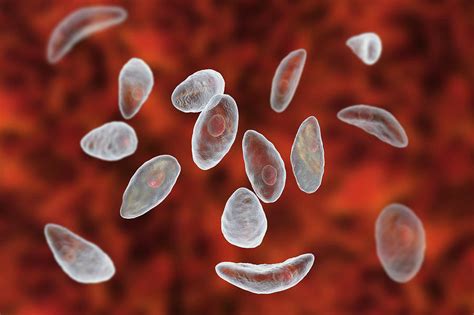 Toxoplasma Gondii Parasites 6 Photograph By Science Photo Library Fine Art America