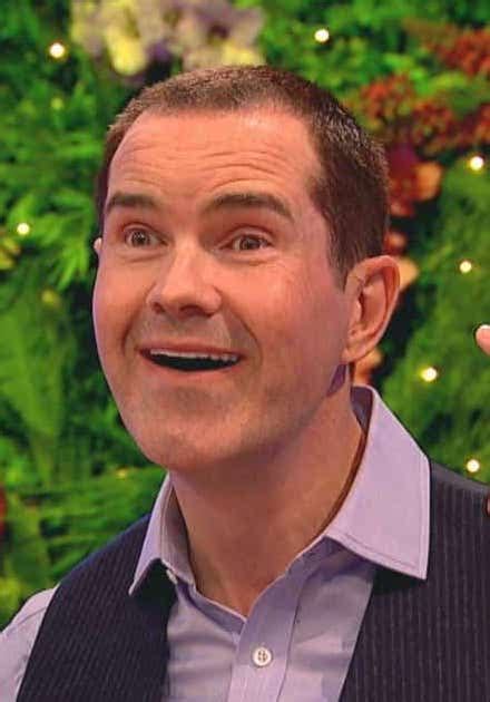 Jimmy Carr Hair Transplant Everything You Need To Know