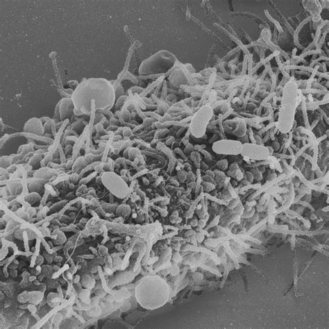 Input image, shows an oblong-shaped bacteria called Salmonella Image ...