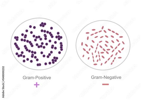 The interpretation result of gram-staining technique that showing Gram ...