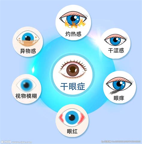 干眼症各种症状眼球结构示意图设计图 医疗保健 生活百科 设计图库 昵图网