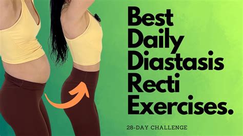 Heal And Flatten With These Daily Diastasis Recti Exercises