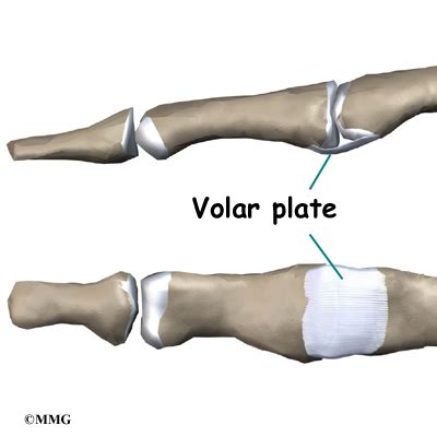 Hand Anatomy - eOrthopod.com