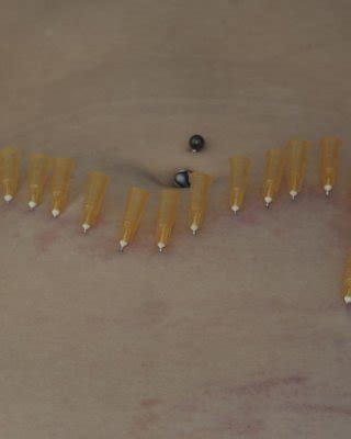 Emilys Extreme Needle Torture And Gagged Medical Piercing Pussy Pain