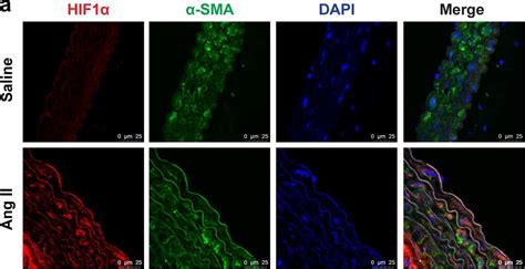 Hif Alpha Antibody H Alpha Nb Bio Techne