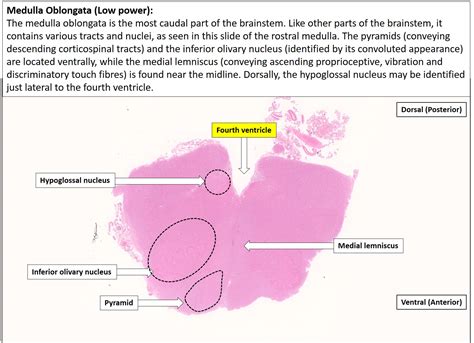 Brain – Medulla – NUS Pathweb :: NUS Pathweb