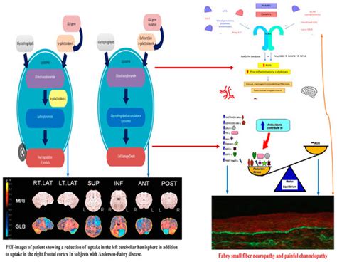 Ijms Free Full Text Molecular Pathogenesis Of Central And Peripheral Nervous System