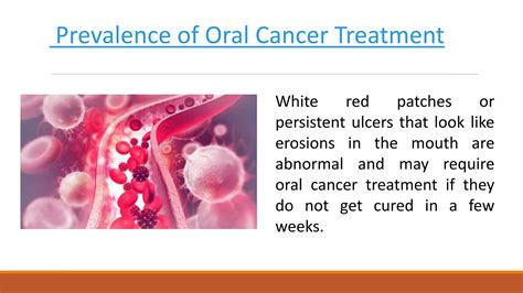 Eradicate Oral Cancer With Mouth Cancer Treatment Ppt