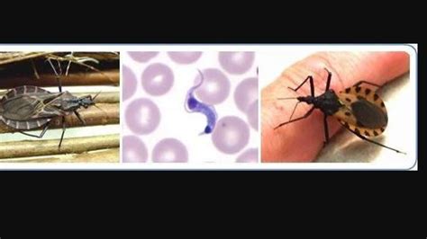 ‘Kissing bug’ disease more deadly than thought | fox8.com