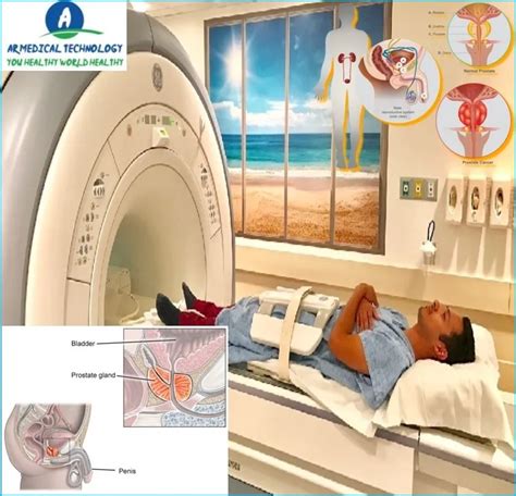 How To Read Your Prostate Mri Best Preparation Protocol 24