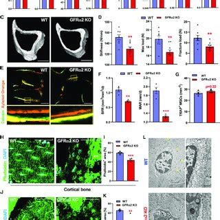 Gfra Loss Causes Osteopenia And Osteocyte Degeneration A And B