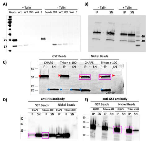 Pull-down assay failed to detect binding between FAT and Talin A) The ...