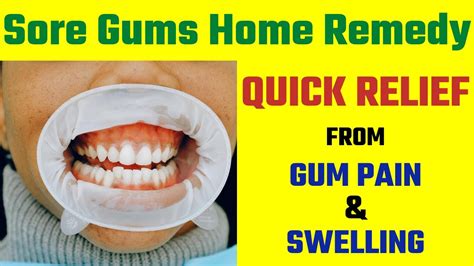 Sore Gums Home Remedy Quick Relief From Gum Pain And Swelling 5