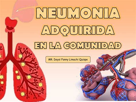 Neumonía Adquirida en la Comunidad DEYSI LIMACHI uDocz