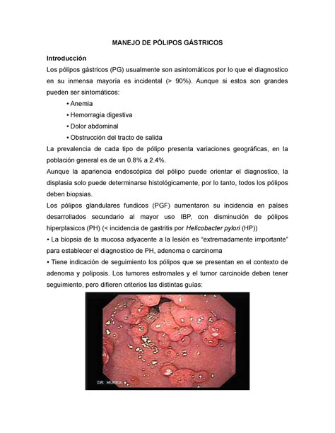 Manejo De P Lipos G Stricos Manejo De P Lipos G Stricos Introducci N