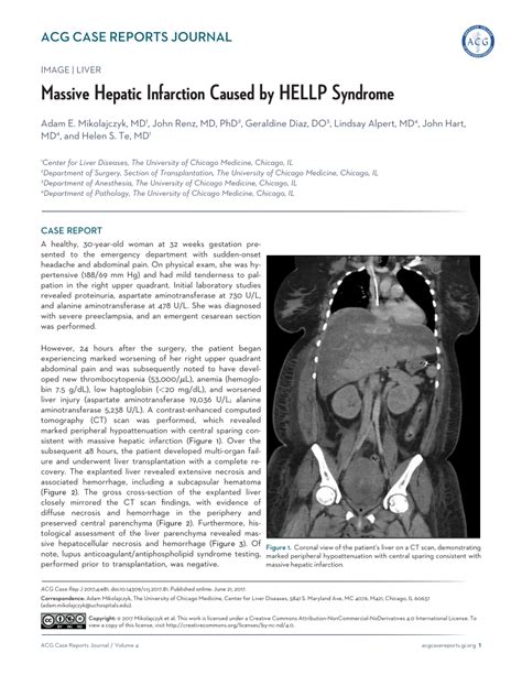 Pdf Massive Hepatic Infarction Caused By Hellp Syndrome