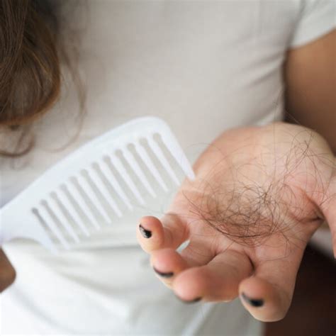 Alcohol and hair loss - woman losing hair on comb which she is holding in her hand