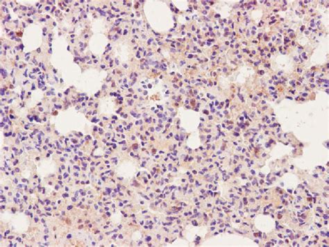 Immunohistochemical Analysis Of Macrophage Infiltration In The Lung