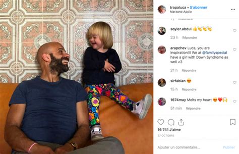 Après avoir été refusée par 20 familles une fillette trisomique adoptée par un papa gay