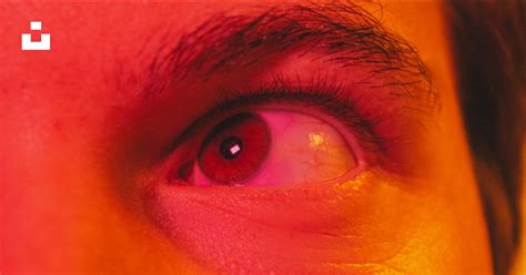 A close up of a person's red eye photo – Free Paris Image on Unsplash