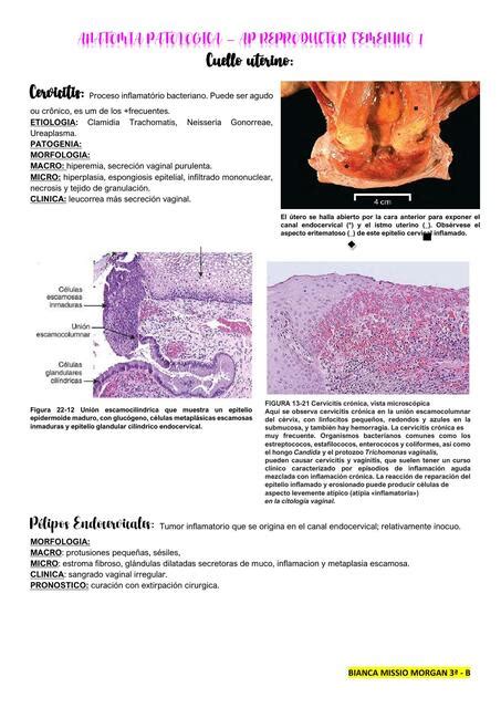 ANATOMIA PATOLOGICA AP REPRODUCTOR FEMENINO 1 Bianca Missio Morgan