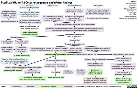 Popliteal Bakers Cyst Pathogenesis And Clinical Findings Calgary