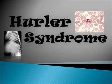 Hurler Syndrome