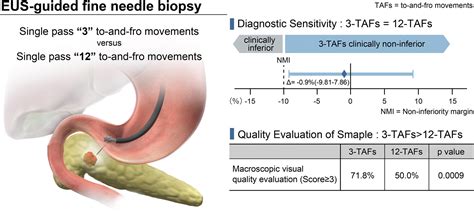 Eus Guided Fine Needle Biopsy Sampling Of Solid Pancreatic Tumors With 3 Versus 12 To And Fro