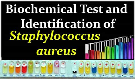 Biochemical Test And Identification Of Staphylococcus Aureus