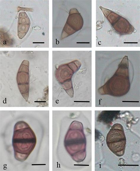 Photomicrographs of airborne Curvularia spores types (a–c: Lunata, d–f ...