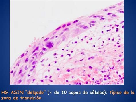 Protocolos De Seguimiento Y Tratamiento De Las Lesiones