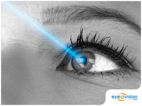 Laser Eye Surgery Common Things To Expect Post Op Eye Vision Care