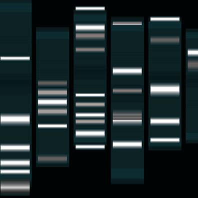 Gen Tica Teste De Dna Dando Nfase A T Cnica De Eletroforese